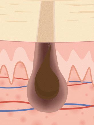 正常な髪の成長